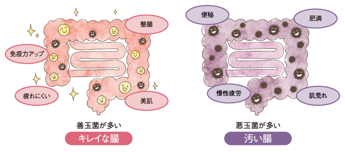 キレイな腸と汚い腸の図