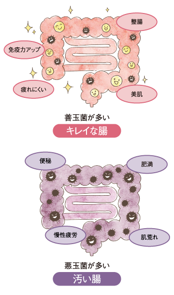 キレイな腸と汚い腸の図